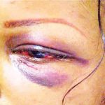 domestic violence