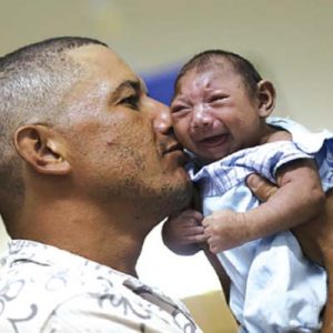 Zika virus infested baby