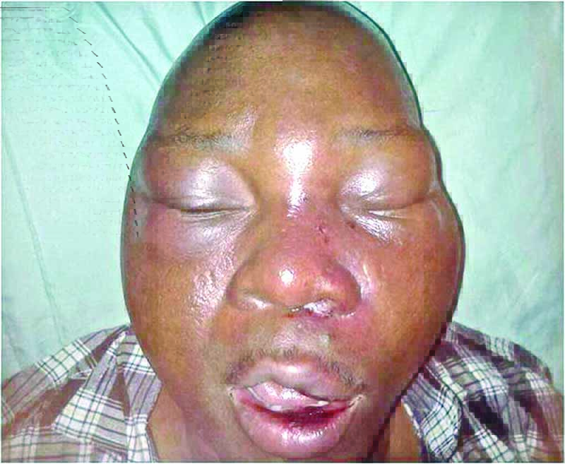 yomi olofecc