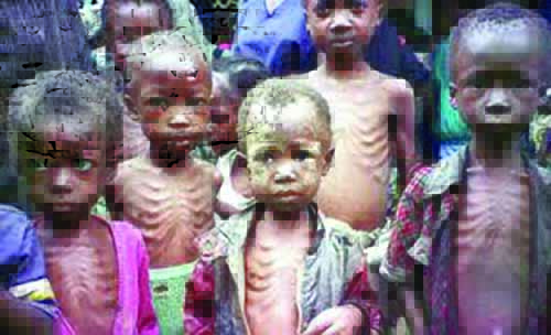 malnourished-babiescc