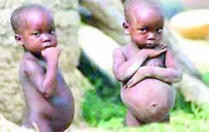 malnourished-kids1cc