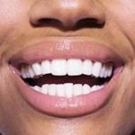 healthy-teeth