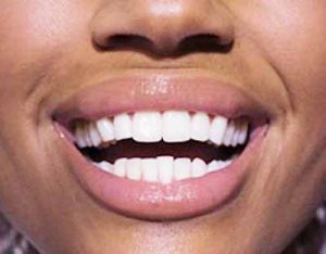healthy-teeth