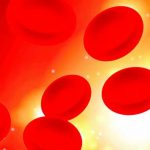 Anaemia