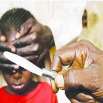 Genital mutilation