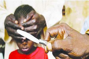 Genital mutilation