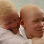 albino