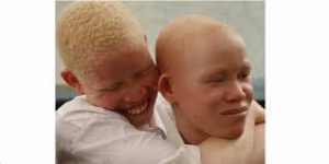 albino