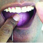 dental