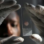 malaria