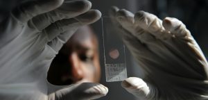 malaria