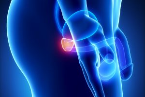 Prostate+cancer