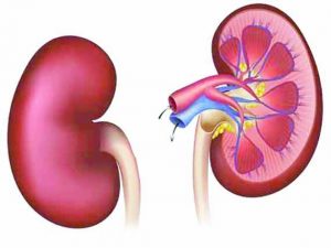 kidney disease