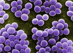 staphylococcus_child