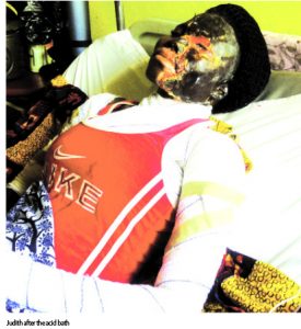ACID BATH
