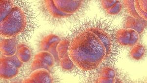 gonorrhoea