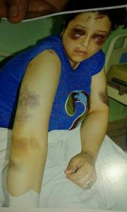 woman battered