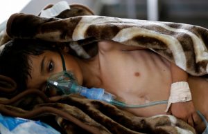 The Wider Image: Risk of famine looms in Yemen