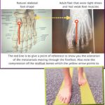 foot