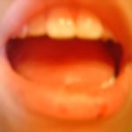 Open_Mouth
