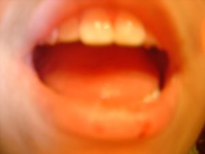 Open_Mouth