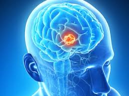 index(50)