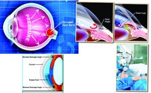 EYE