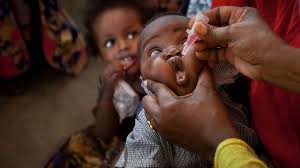 measles