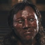 dark skin