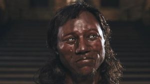 dark skin