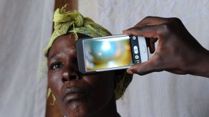 eye glaucoma nigeria
