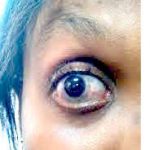Eyes