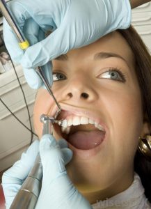 woman-looking-over-at-dentist-in-latex-gloves-working-on-teeth