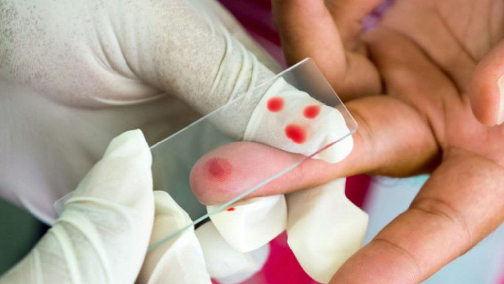 malaria-1