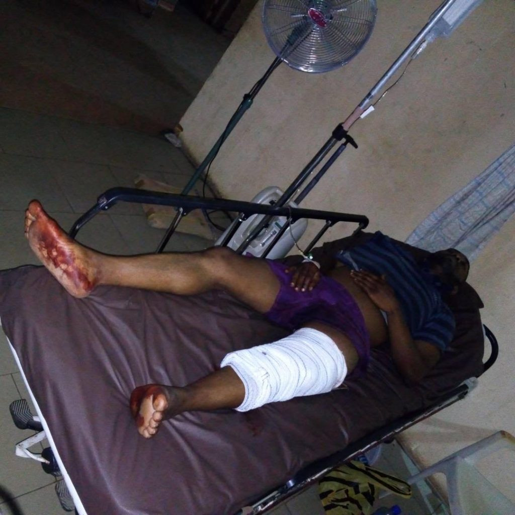 ADO EKITI APC AIDES ATTACKED