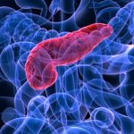 ACUTE PANCREATIS