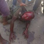 ACCIDENTIAL DISCHARGE – AIDE SAYS