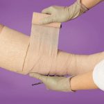LEG ULCER