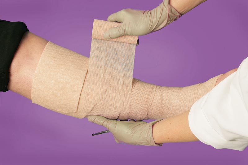 LEG ULCER