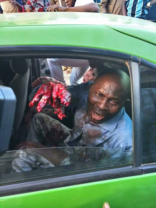 TAXIMAN SHOT BY POLICEMAN