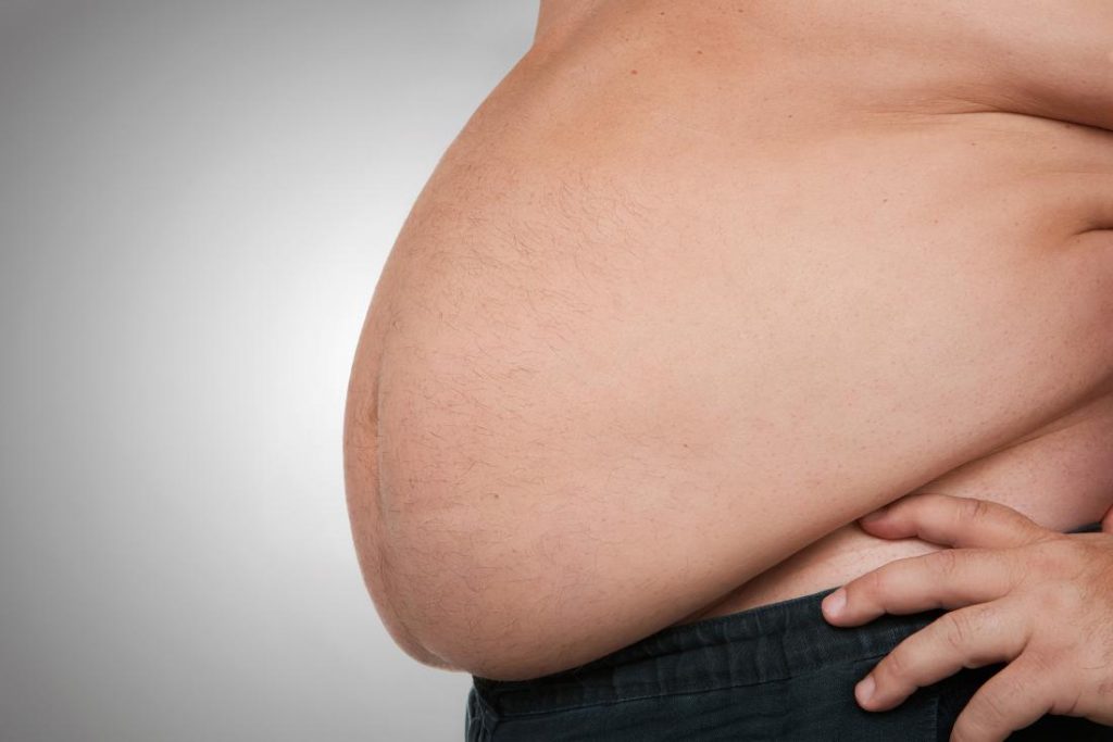 obesity