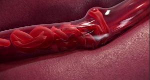 sickle