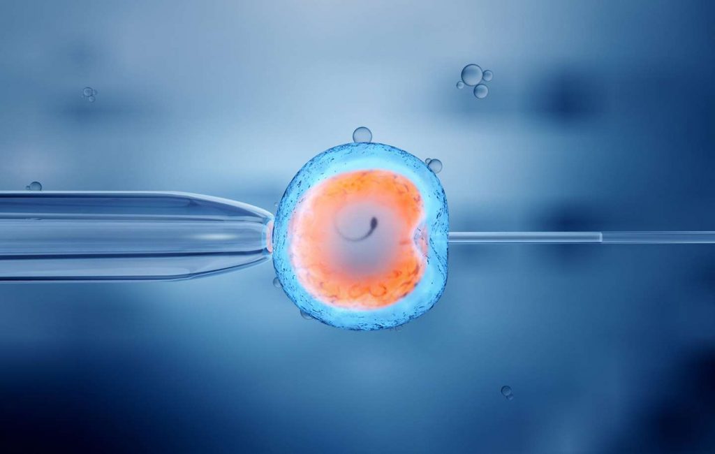 IVF