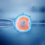 IVF