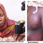 BURNT BUTT_censored