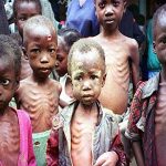 malnutrition