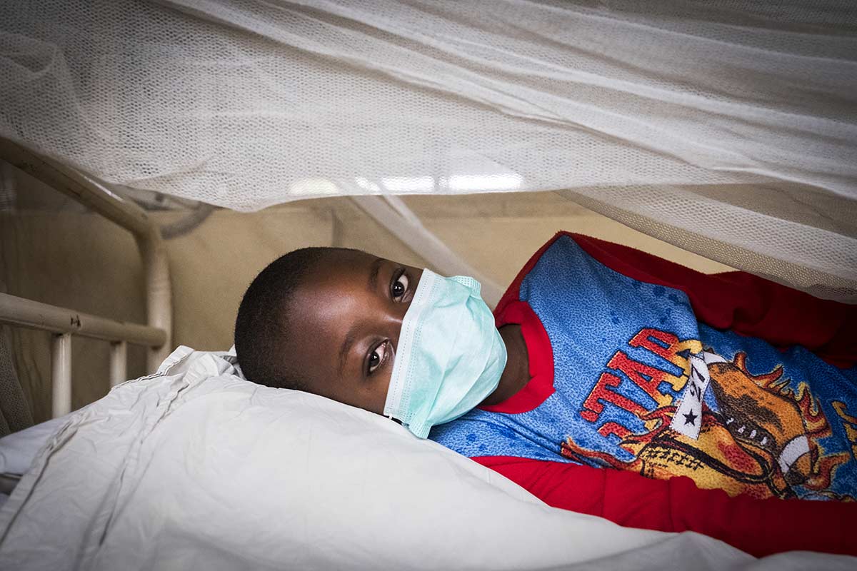 Tuberculosis