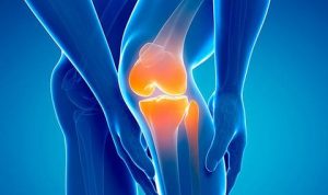 Arthritis_large