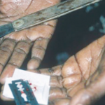 Female Circumcision