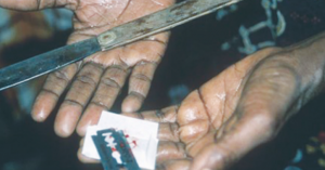 Female Circumcision
